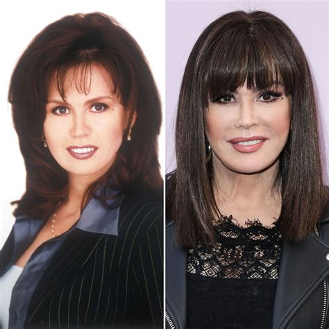 bad plastic surgery marie osmond