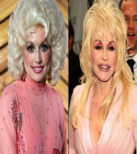 bad plastic surgery on celebrities