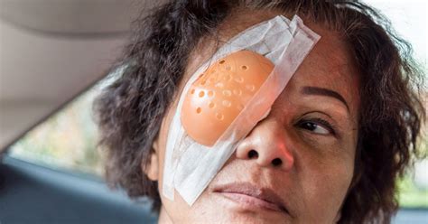 baggy eyes after cataract surgery
