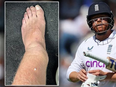 bairstow injury