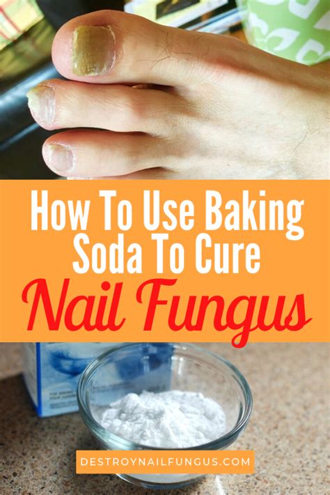 How to Use Baking Soda to Cure Toenail Fungus Life Healthy Tips
