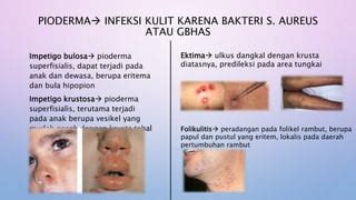 Bakteri Kulit