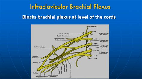 Balance Vs Block Plexus
