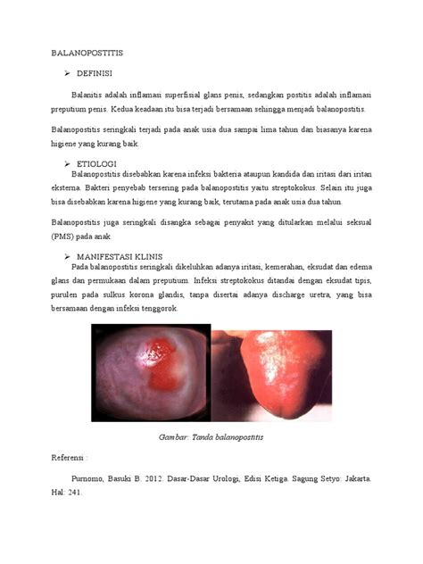 Balanitis dan Postitis