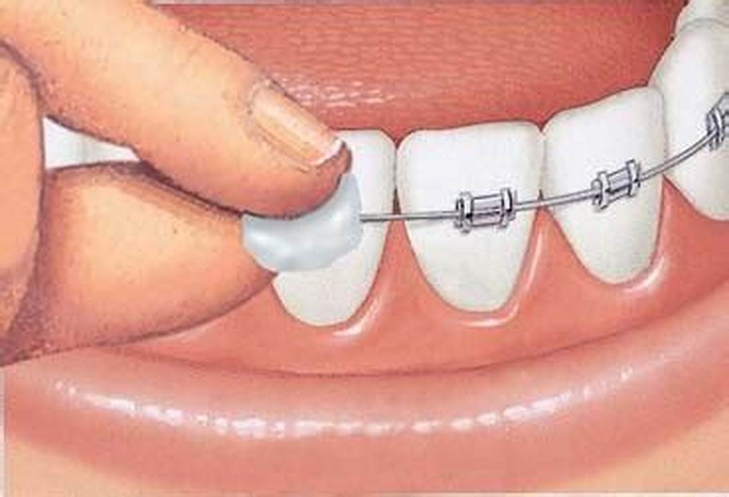 banyak waktu perawatan ortodontik