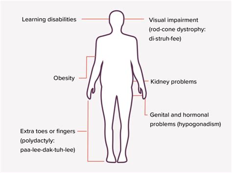 bardet-biedl syndrome symptoms