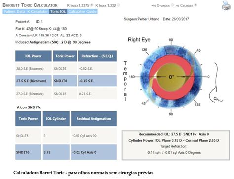 barett toric calculator