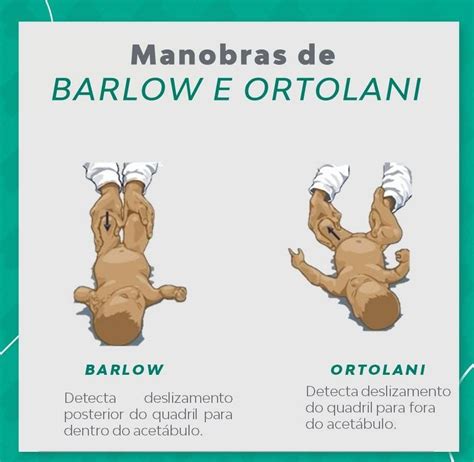 Barlow Ortolani