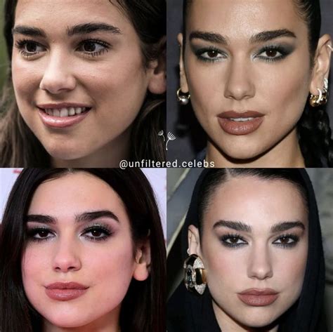 Bars Plastic Surgery