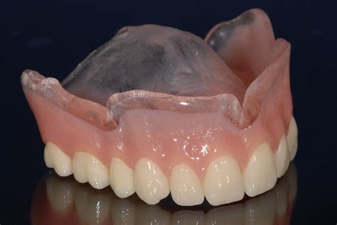 Base Plate Full Denture