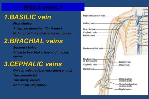 Basilic Vein Catheterization Cpt Code