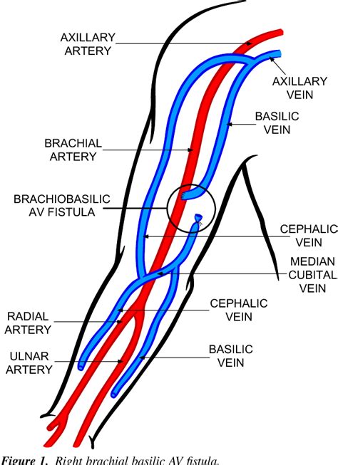 Basilic Vein Is A Branch Of
