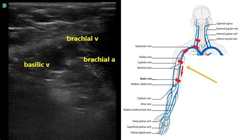 Basilic Vein Us