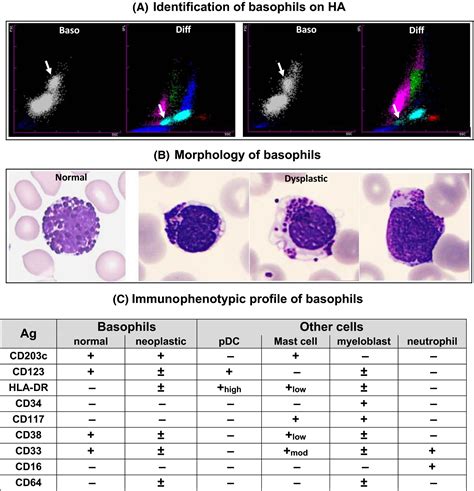 Basophils - Abs (Diff)