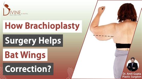 Bat Wing Surgery Cost