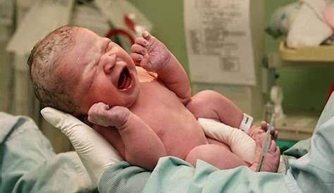 5 Kondisi Ini Wajar Terjadi pada Bayi Baru Lahir - Alodokter