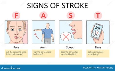 Mastering the Be Fast Stroke: Unlocking Efficient Swimming Techniques