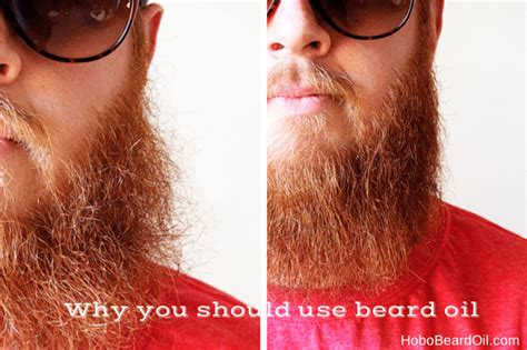 Beard Oil Why Use