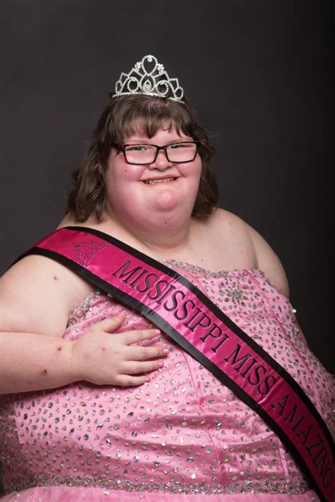 beauty pageants cause eating disorders