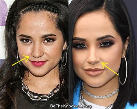 becky g plastic surgery