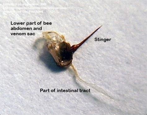 bee sting stinger not removed