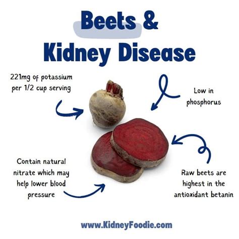 Beets On Kidney Diet