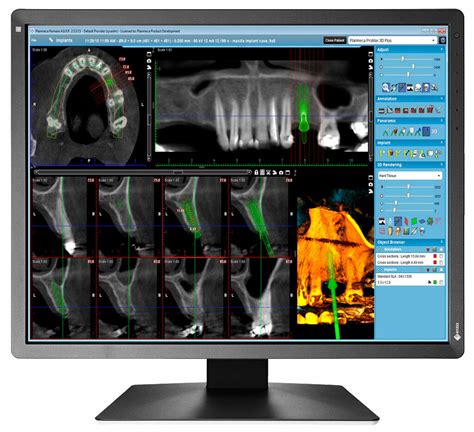EIZO Medical RadiForce MX215 Befundungsmonitor mit 5 Jahren Garantie