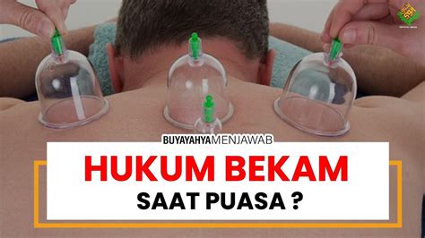 Bekam Saat Puasa