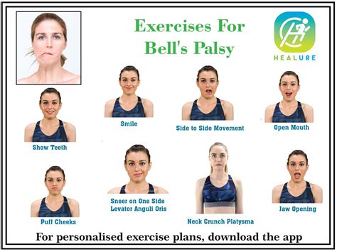 bell's palsy exercises chart