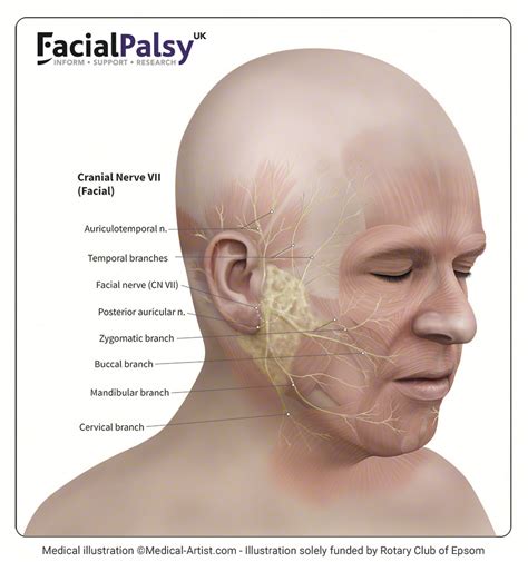 bell's palsy facial nerve 7