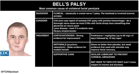 bell's palsy lab tests