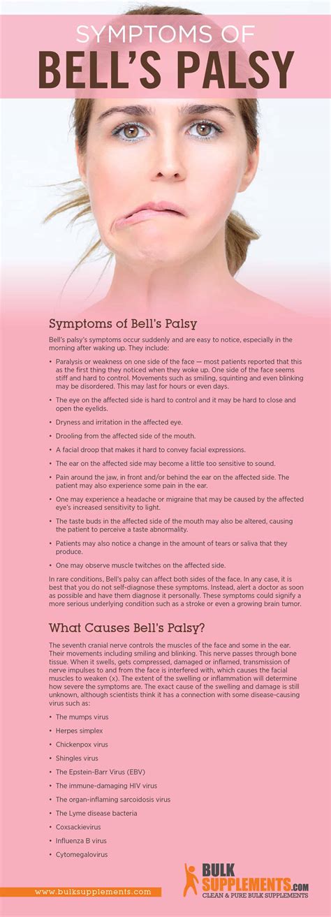bell's palsy length of symptoms