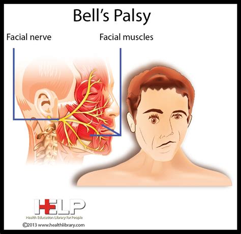 bell's palsy nervous system