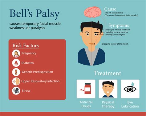 bell’s palsy symptoms vs stroke