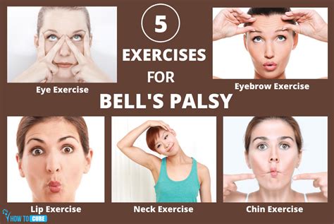 bell palsy physical therapy exercises