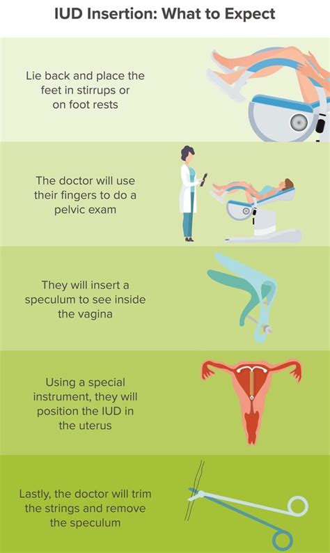 benefits and risks of iud insertion