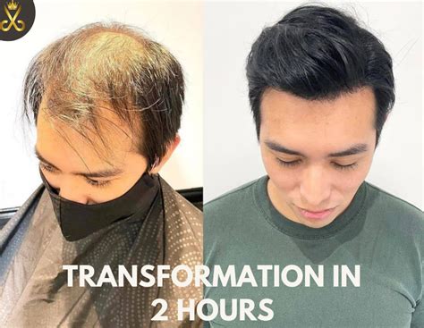 Rahasia Pertumbuhan Rambut Pria Terungkap: Panduan Lengkap