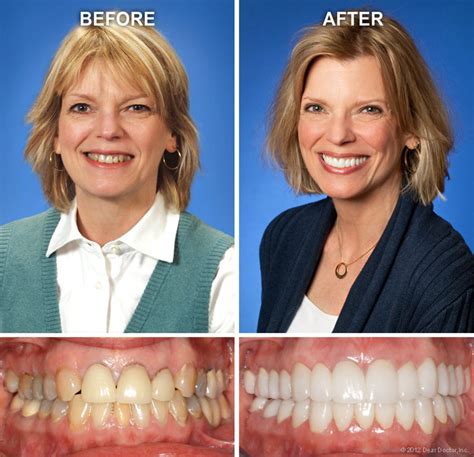 Common Cosmetic Dentistry Procedures Love Your Smile