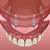 best dental implants houston