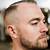 best haircuts for male balding