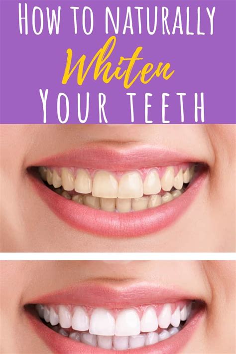 Beauty The Best Natural TeethWhitening Methods INSCMagazine