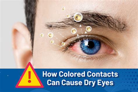 best color contacts for dry eyes
