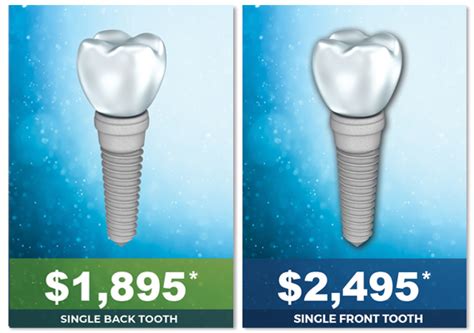 best dental implants cost and quality