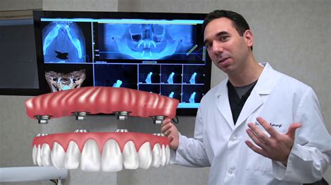 best dental implants reviews