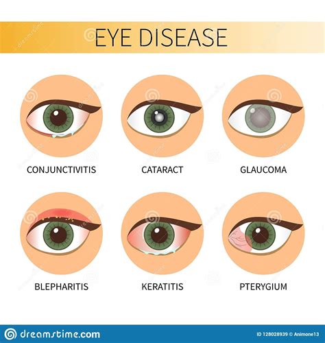 best eye disease symptoms