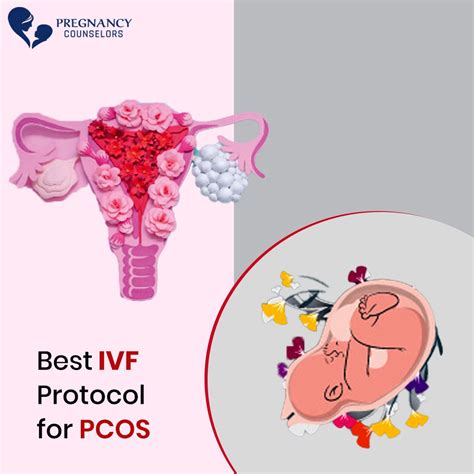Best Ivf Protocol For Pcos