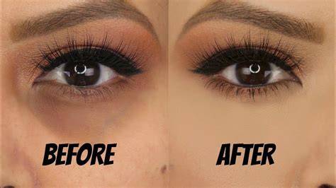 Best Makeup Coverage For Dark Circles