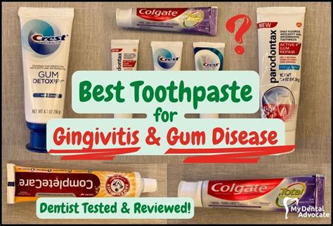 Best Otc Toothpaste For Gingivitis