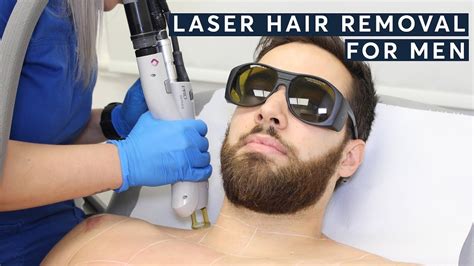 best professional laser hair removal for men