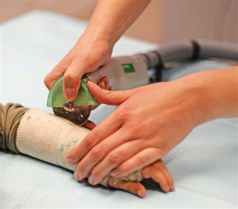 Best Tool To Remove A Cast
